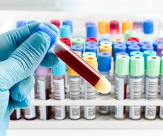 Medical Tests